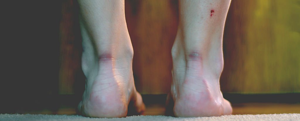 Scientists have figured out how to make wounds heal without&nbsp;scars